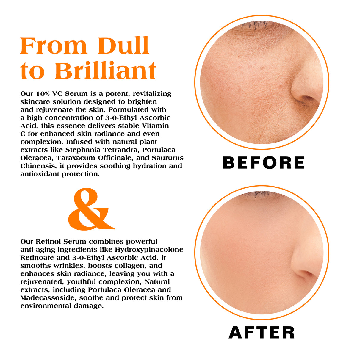 Séfralls Vitamin C + Retinol Serum Duo | Brightening & Skin Renewal Facial Serum Set